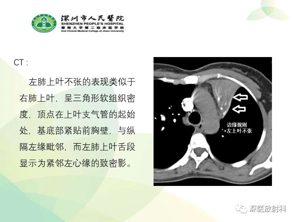db20799a75a3893ccb18a9d72836e3ad.jpg