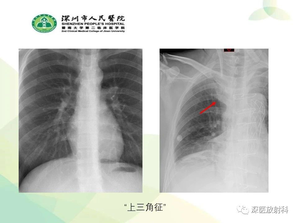 a59761cc6eb4464bb415755cd129ea49.jpg