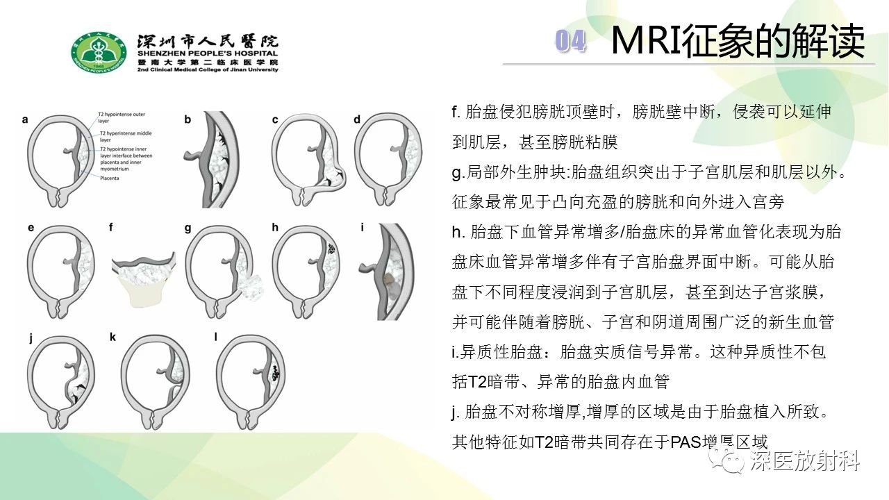 c52bce6b39bd7940d28b25c53ac5a795.jpg