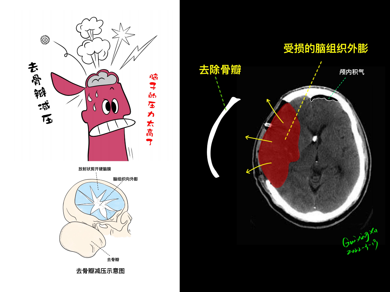 26f725f084d9922bc400ed07d0a6578a.png