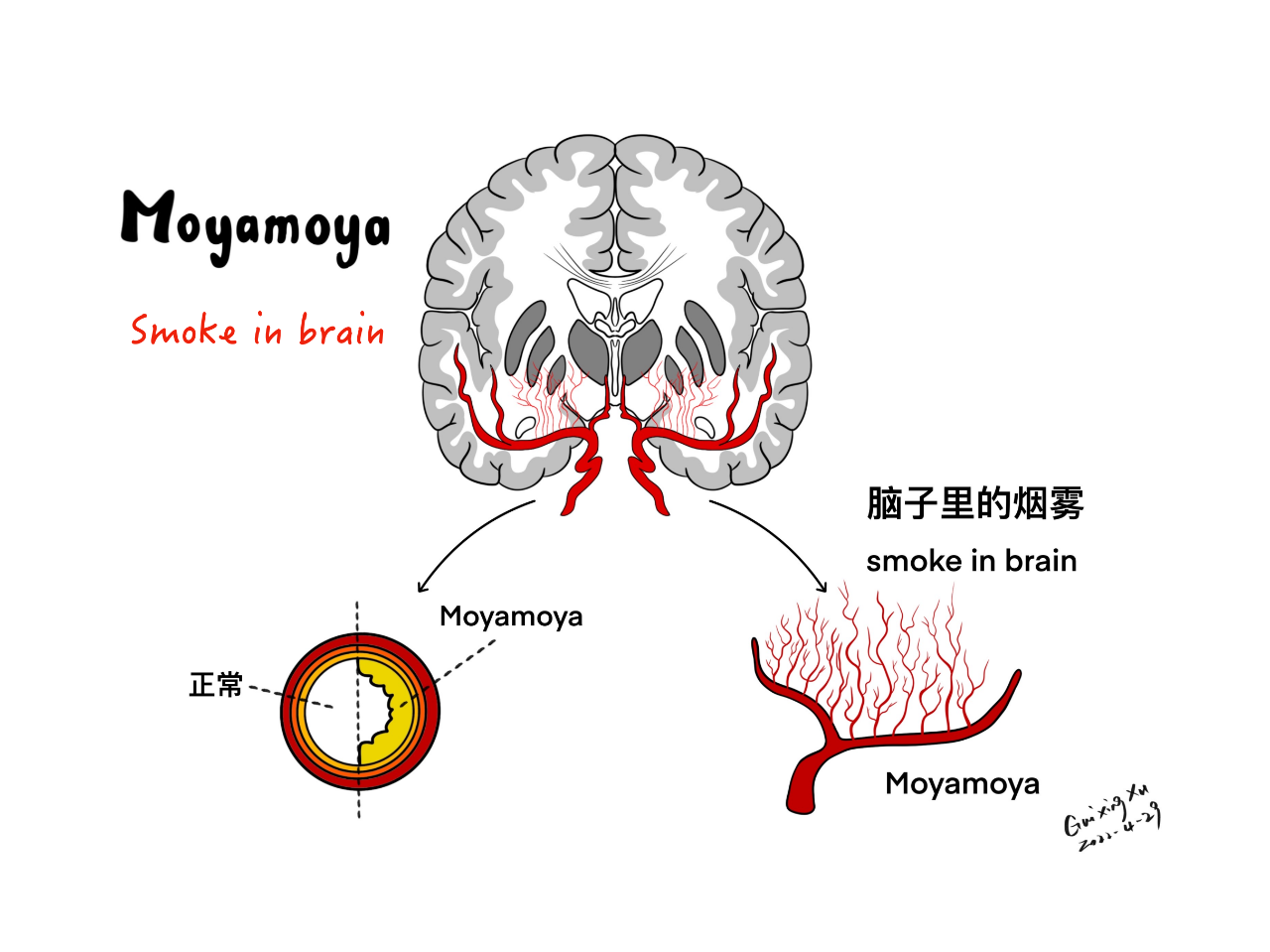 3314a6ef18a1dd99123f2c9ac4ec867f.png