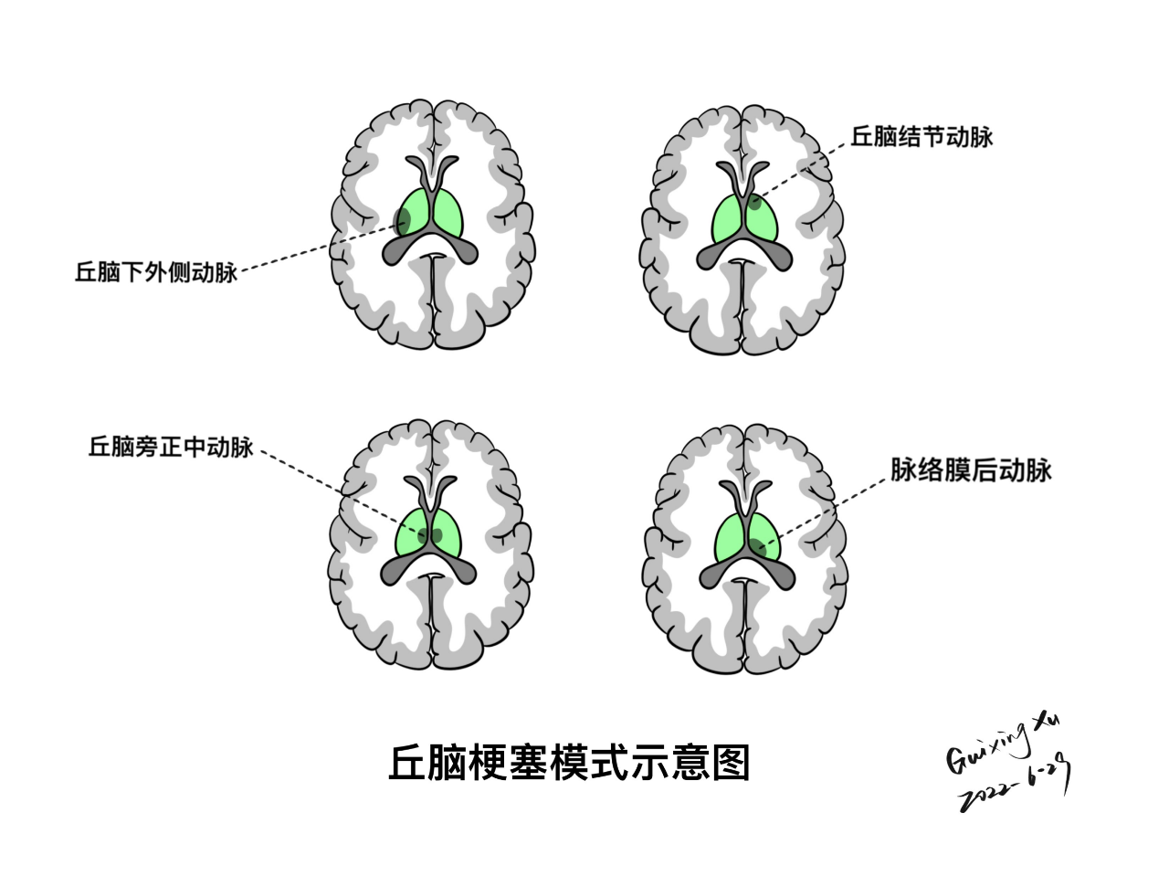 b7be2e84d6e4ae590a2935dfb3cba3e9.png