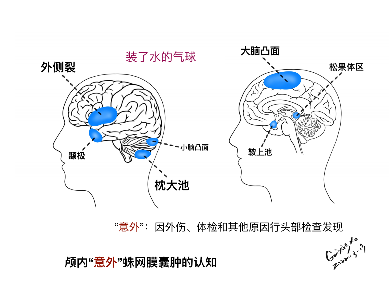 48c52c5fe437a65e292bc935c2ea069e.png