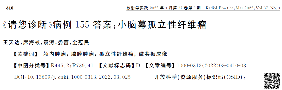 32f0e45eb7dc38b54fac11bb0257ac5d.png