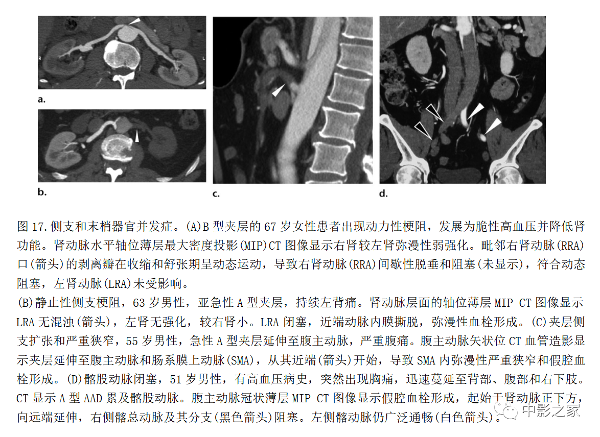eadfc69de4b12a6973cbbd4aaab72b97.png