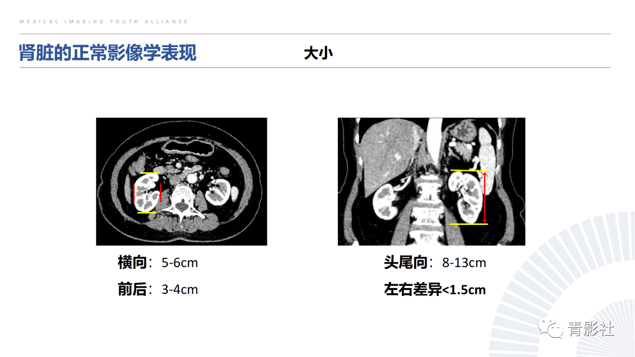 114e04c7bb8002affc7297571067b233.png