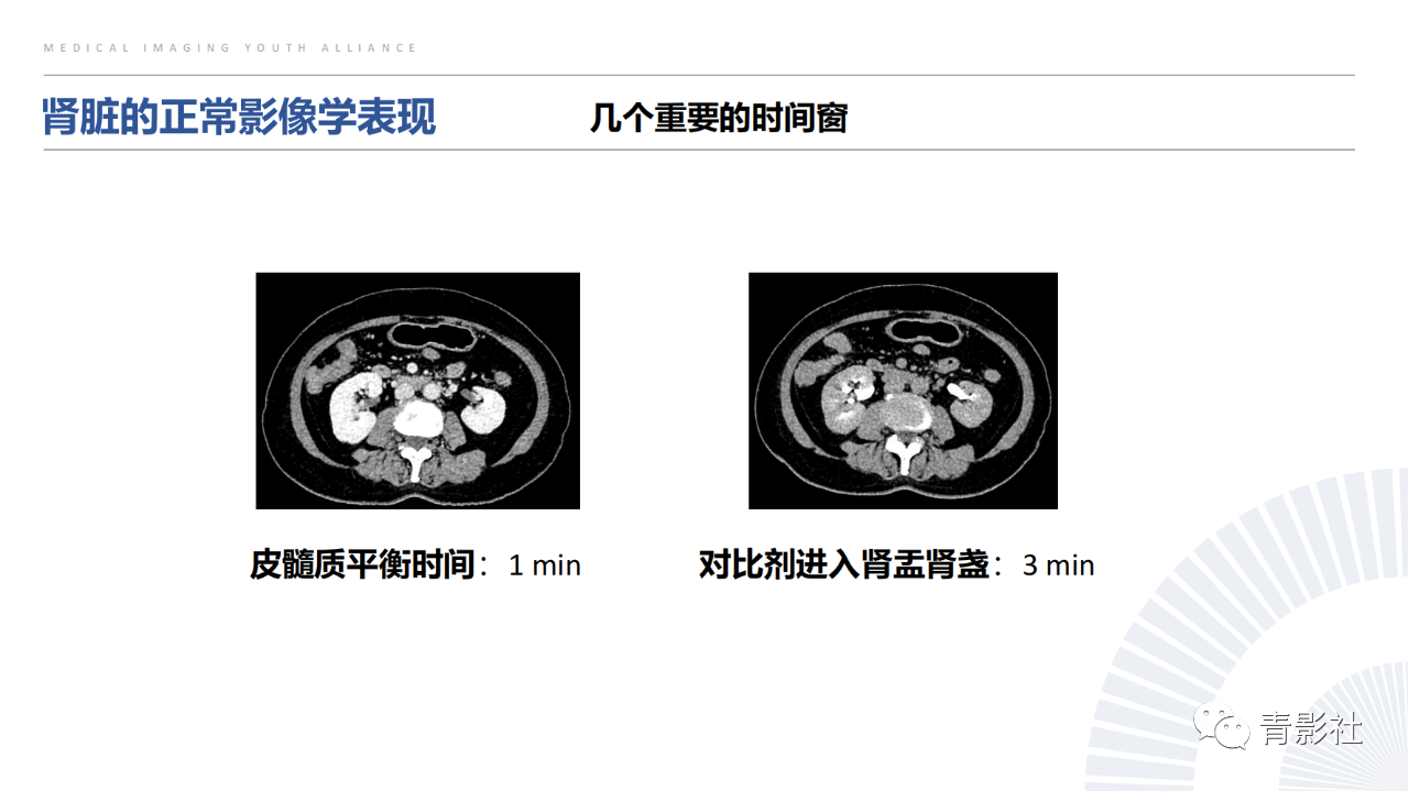 5a78dca17969ce6318fe2703925ac365.png