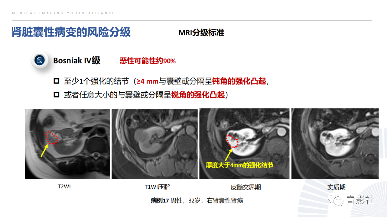 fb19594dc244f917ae34f0178a2008dd.png