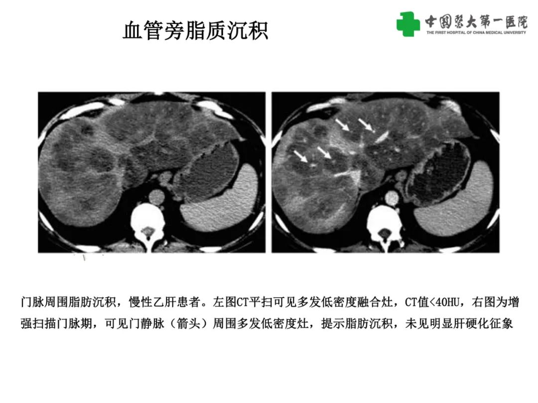 cb013de3594dbc0fe388a55a5e88528e.jpg