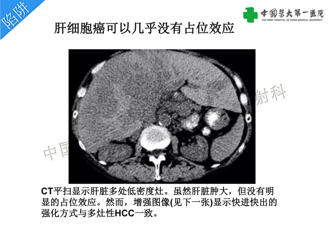 6d34f82de2ceb5211d7fa59119107a9e.jpg