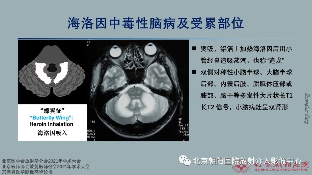 57469be9ac2d3d8746bad51fda1754da.jpg