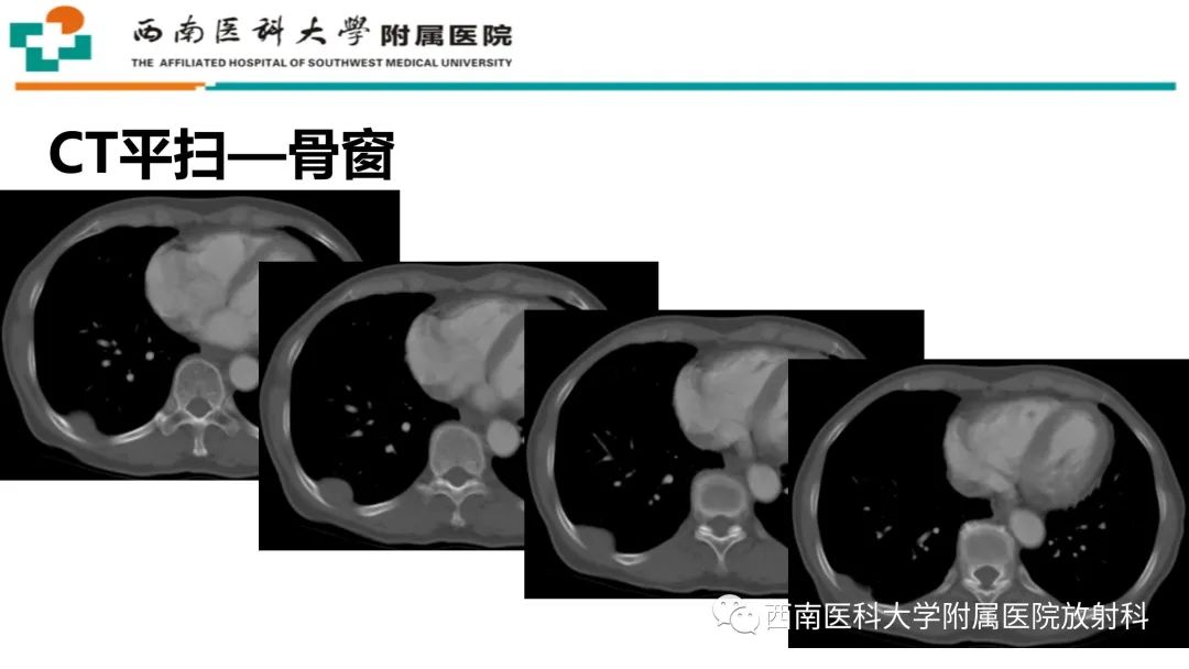 ccd87c6eafcfe485e5c53937bf1f8395.jpg