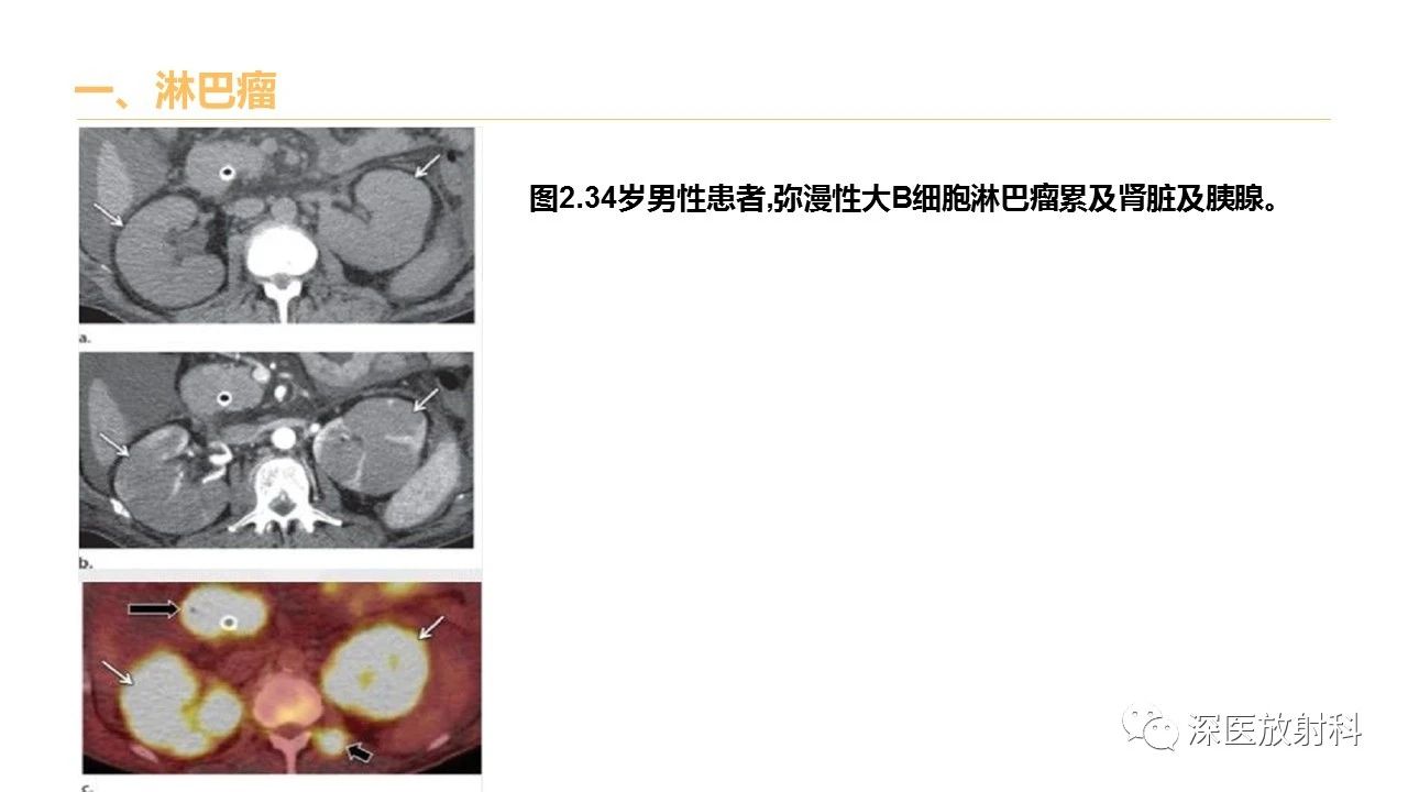 f9574ff2f70b7b940e74cd6e12720841.jpg