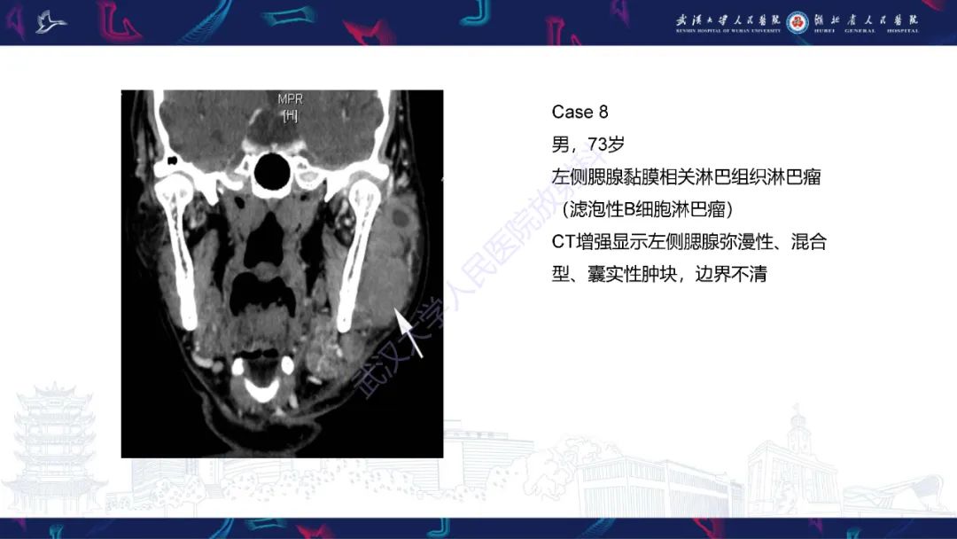 2b203a998a24fbce9800831cd29c0cb6.jpg