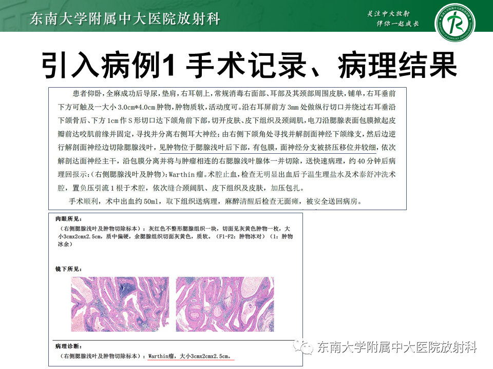 ff644916b873b1543a0a13c48baeab9f.png