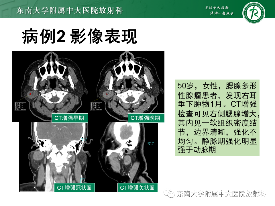 a38a9efe9c5fd2a125866b1ce24fc66c.png