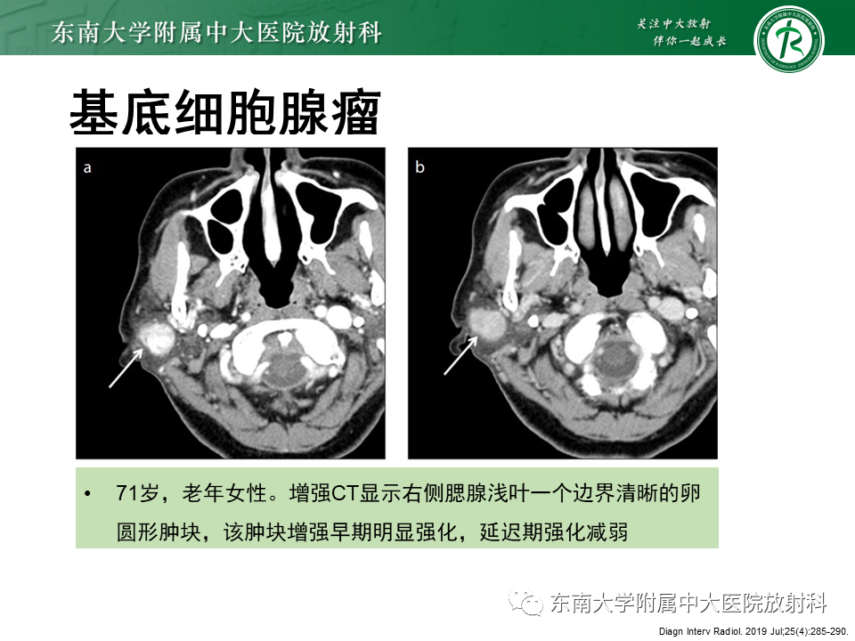 ff0c1b187285bb5465ef0c1dccf09bc7.png