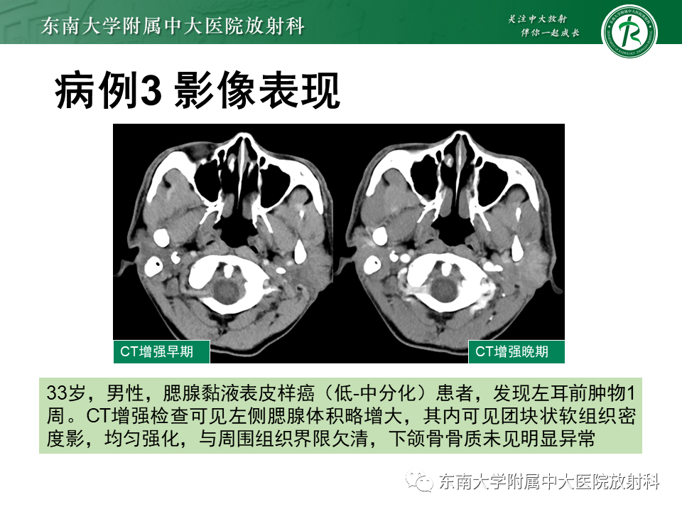 fa409b56c1b62013abe2001fe6b09666.png