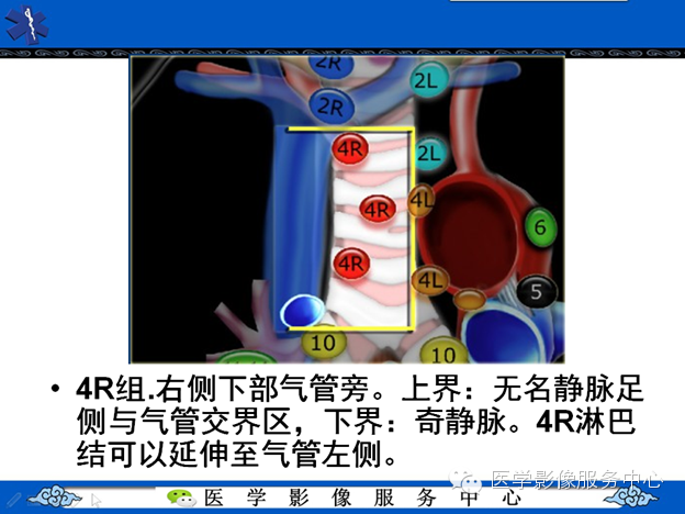 4bf6c80e7ed9620fee87ab63aaa3f31a.png