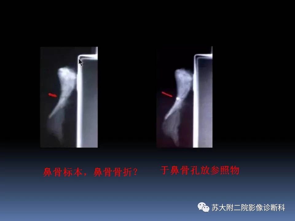 a2094c334da15ea2cdd324deb7274fc2.jpg