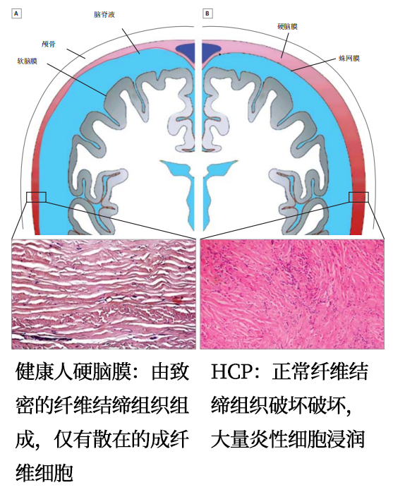 4ecf211d406766b48076a4105bc28a5d.png
