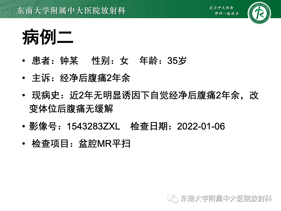 d58455d288f459c04e1c31b6b5b4938b.png