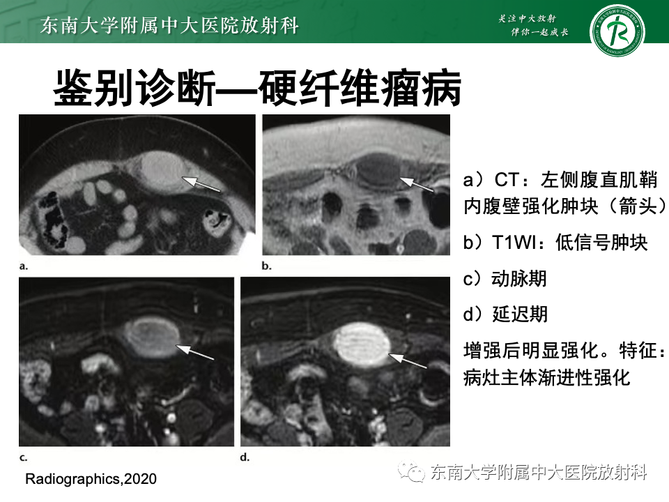 287e34fc2cf7a08ae8bfc9c5d490e37b.png