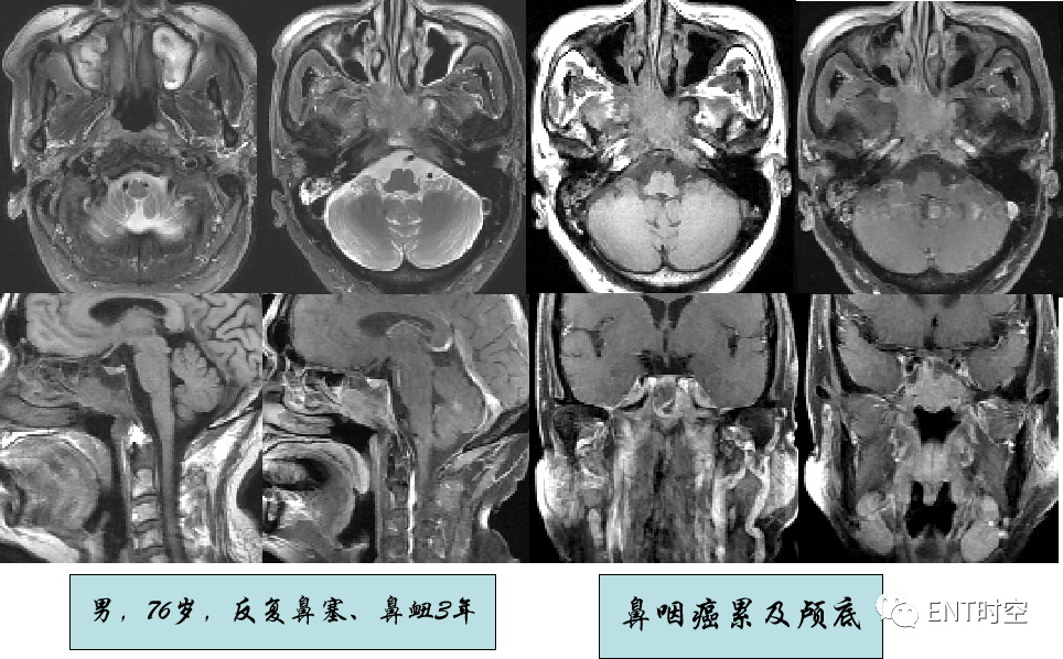 ae32c396e5269f7b6ca18a3a75df9321.png