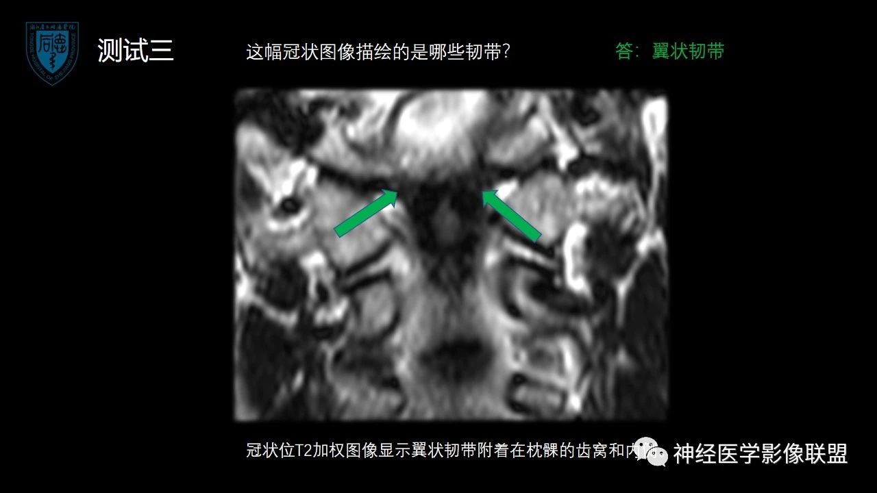 93132ddc63de5fc1101c158b90b95bcb.jpg