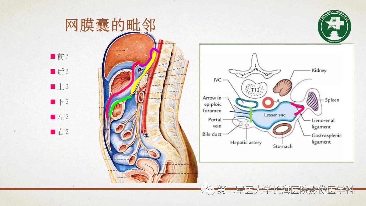 cf9ee6064e0ce73e850a703b82ec599f.jpg