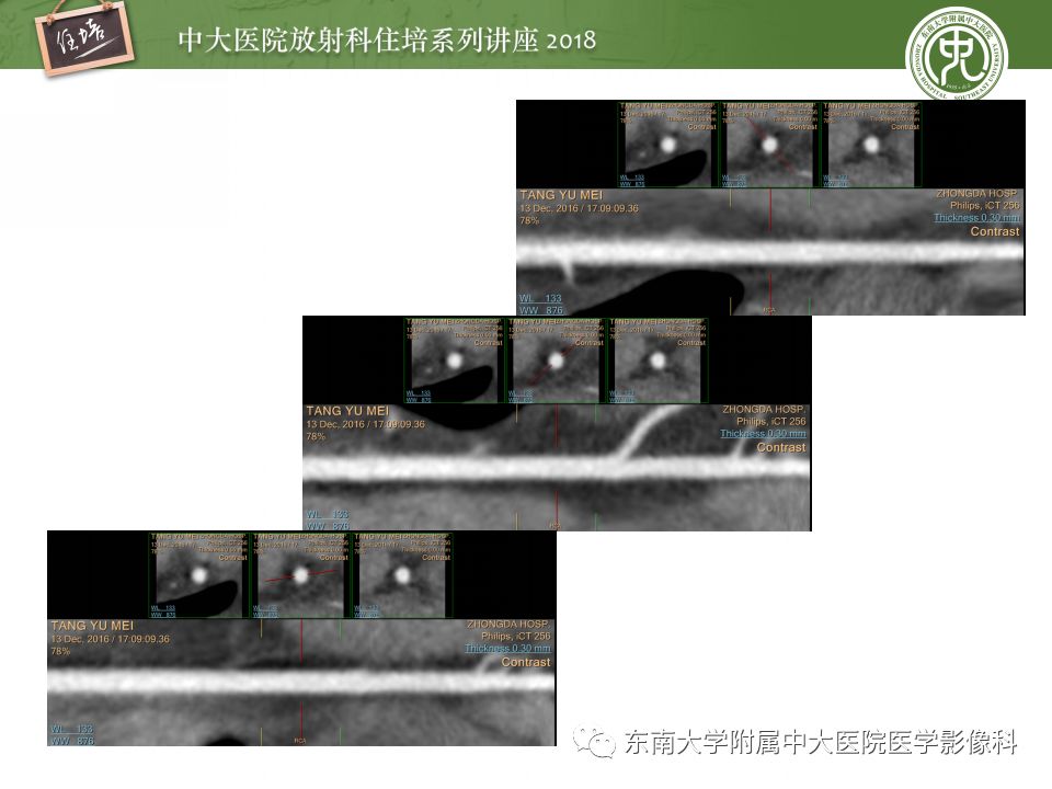 5d264a8243f203f414a40c000a32ca9d.jpg