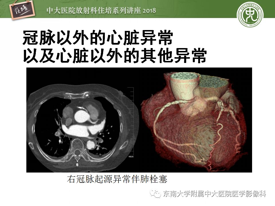 c8309c298b1cbb7a60aac7dc54cd1b8e.jpg