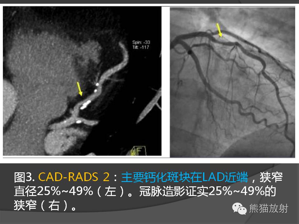 bf84853cb30bedb12e8cb3fa083b2bd4.jpg