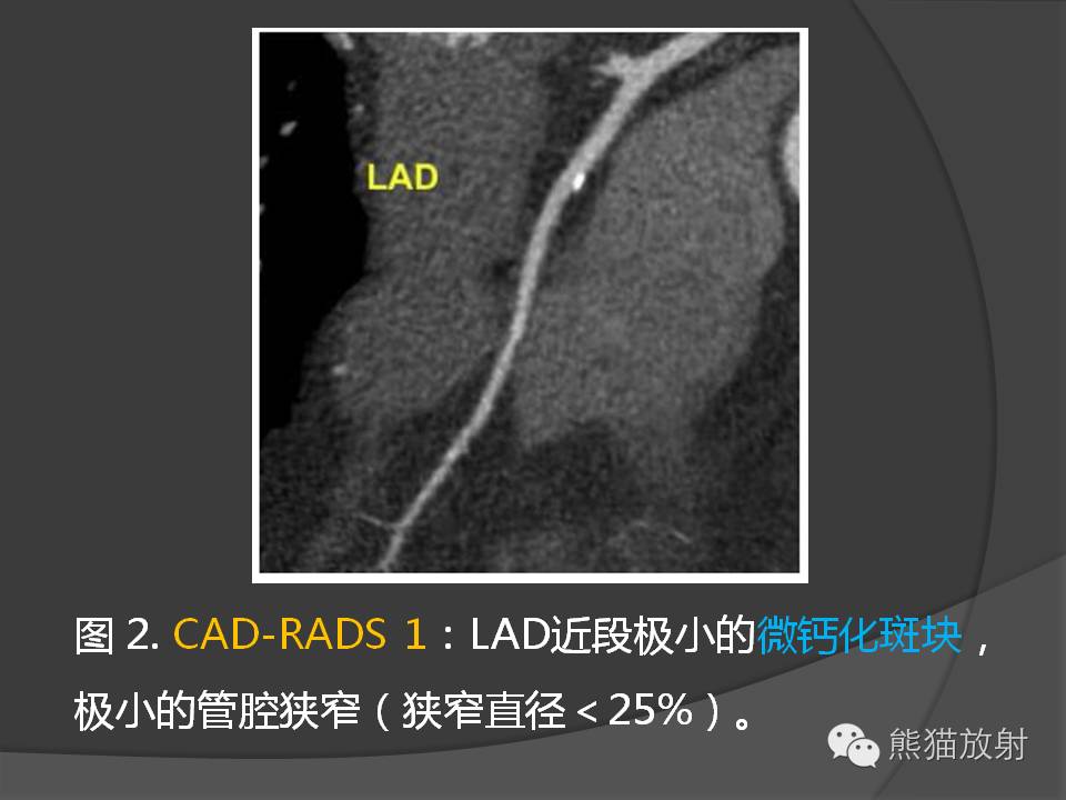 1ef61cd290d417640e6a049eccb8d6cf.jpg