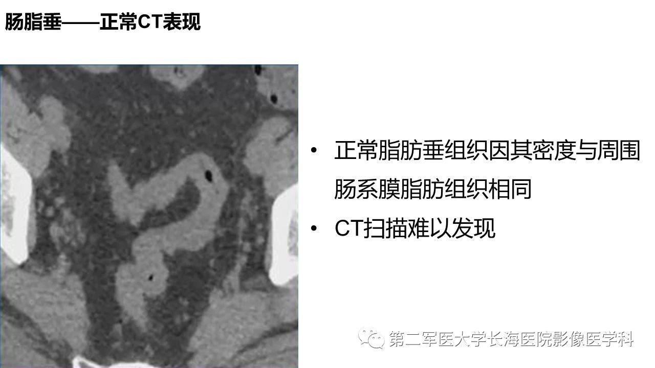 fecac44b58ef09881465a4f651293929.jpg