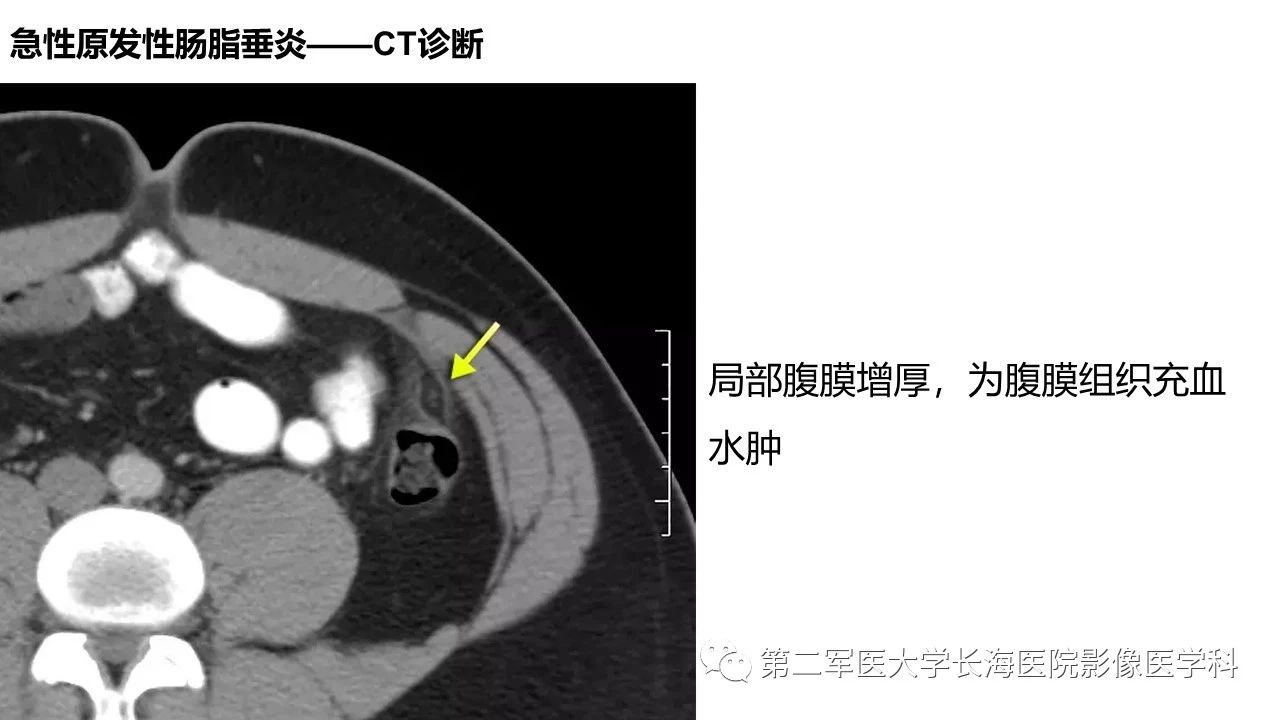 ec93edbe2056f7bd5b911a3c19531162.jpg