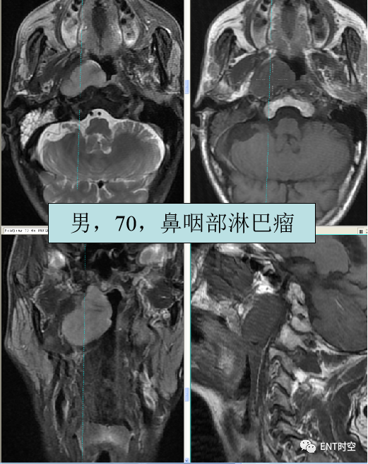 d17d6e3ccf3f70aa2cad31f3811ec731.png