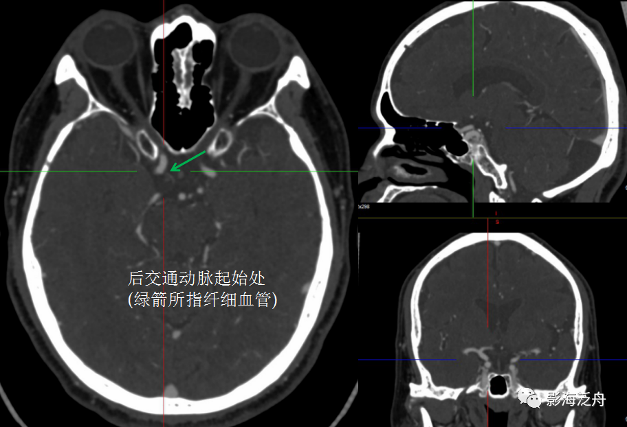 c266015755a9547e0e3629c52fd6846a.png