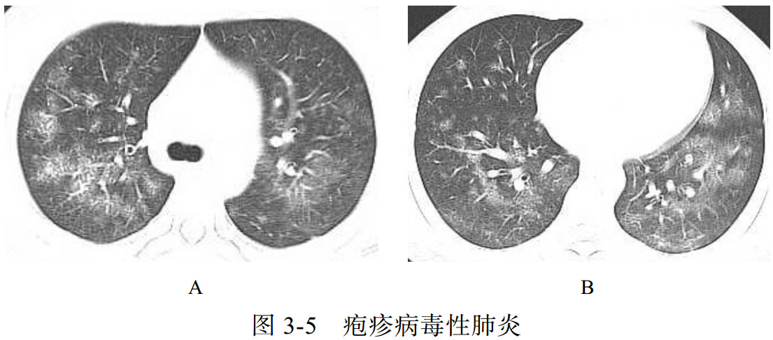 7decd8a1cfa8f860504e3864c967adfc.jpg