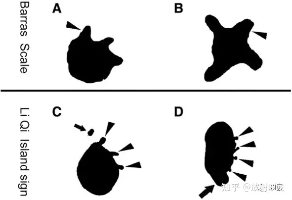 v2-55921ed8340717e5170687b39462e53d_720w.jpg