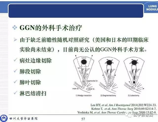 qw57.jpg
