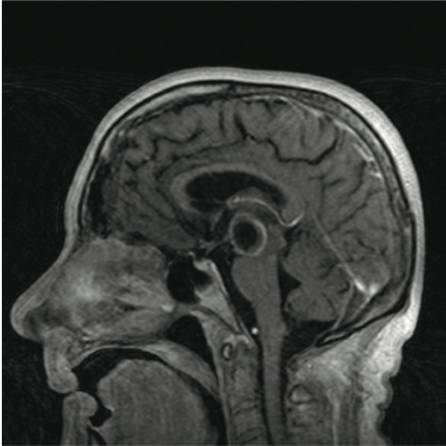 56911654816445127.jpg