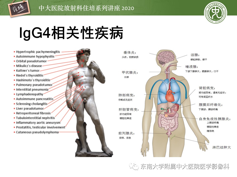 a2edbc794a72d90d0f935d04fec13d1d.png