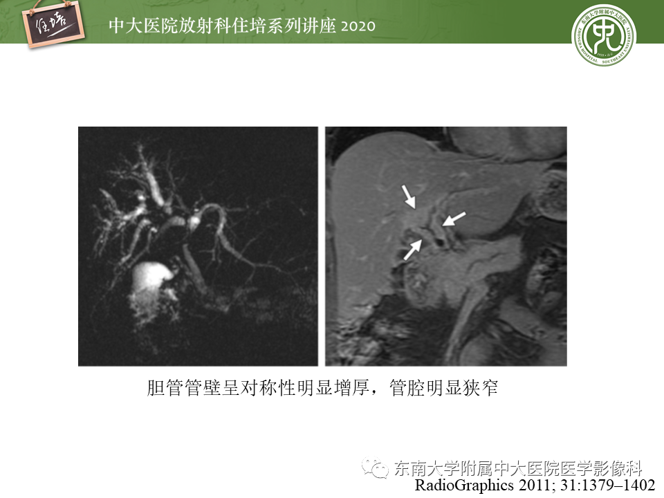 e247547ff2b726a008314cb6d85a5874.png