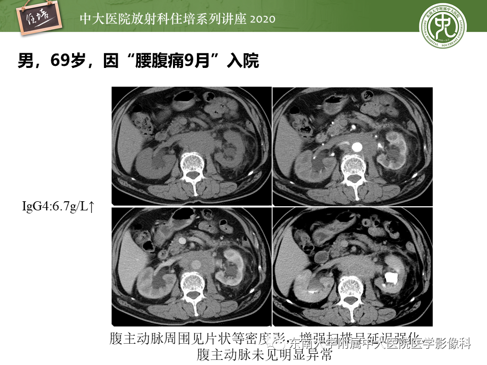 cb8840ffdff3323d1ef104842a5bd0a0.png