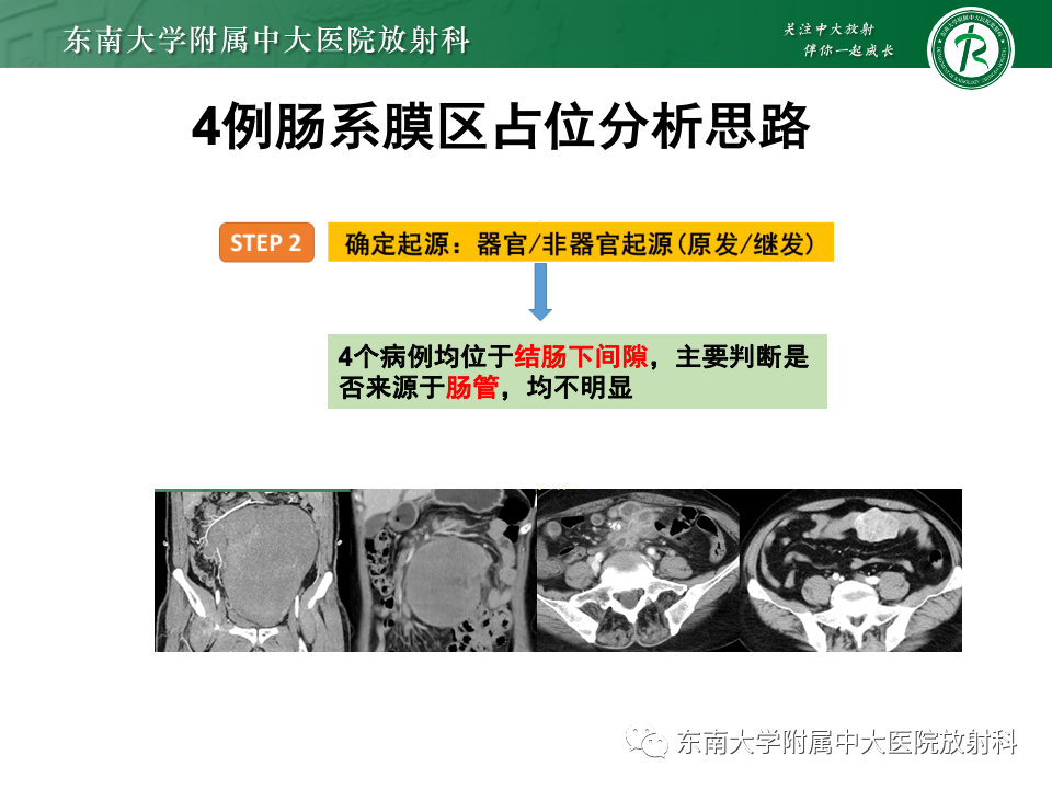 2b84c9f5ab9655c2f0088d11d2e50091.png