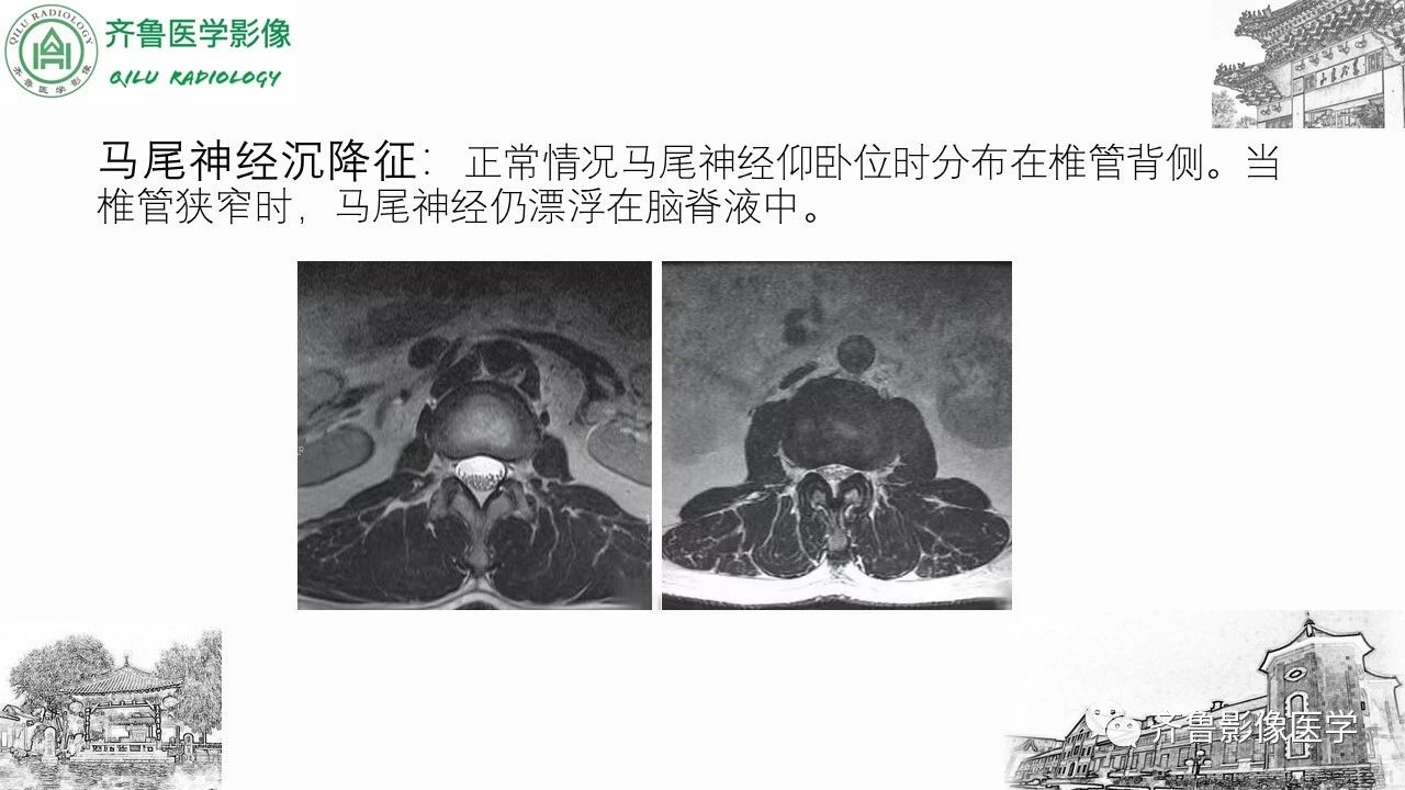 d6c10e39dd4c4805734335aaf78b6b35.jpg