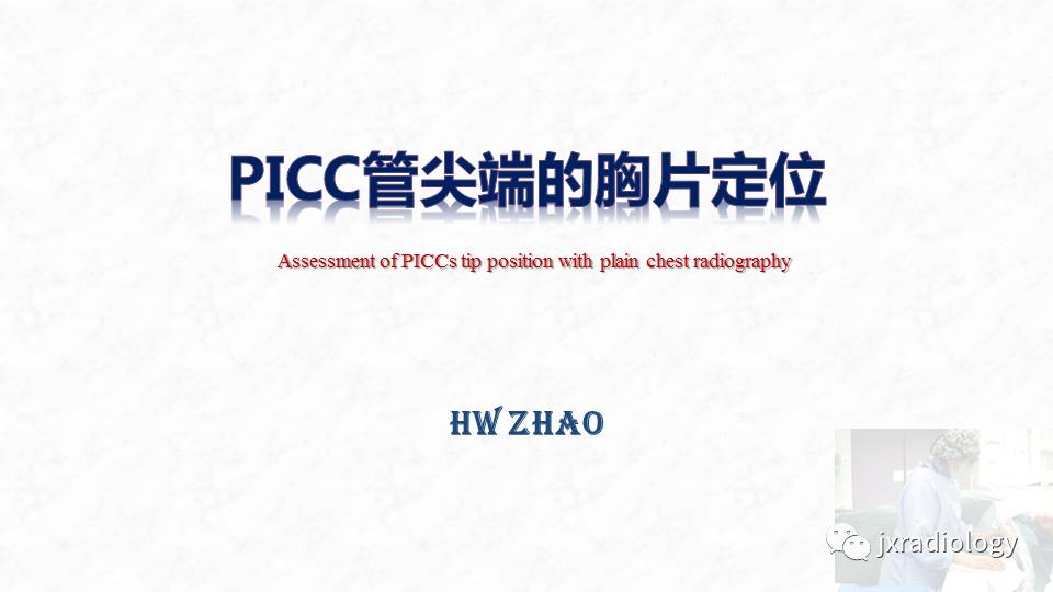 4caa47eb0b6fbe032b604711e7ab6770.jpg