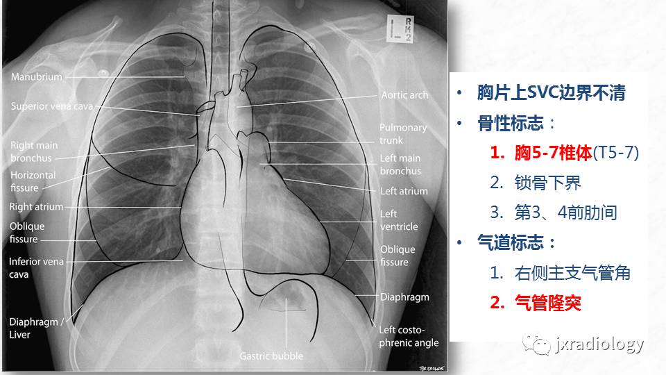 df5cf499d87931a873ebaab777b785b3.jpg