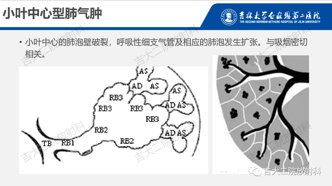 c6087b4bddb12b53ff58b2ddd98f4ed1.png